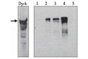 Image no. 1 for anti-Dual-Specificity tyrosine-(Y)-phosphorylation Regulated Kinase 1A (DYRK1A) (AA 486-763) antibody (ABIN264978) (DYRK1A Antikörper  (AA 486-763))