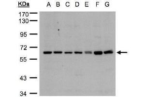 Western Blotting (WB) image for anti-Cytochrome P450, Family 24, Subfamily A, Polypeptide 1 (CYP24A1) (Center) antibody (ABIN2856211)