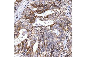 IHC analysis of Rab4/RAB4A using anti-Rab4/RAB4A antibody (ABIN7599733).