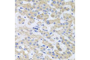 Immunohistochemistry of paraffin-embedded human liver injury using PEX3 antibody (ABIN5975508) at dilution of 1/100 (40x lens). (PEX3 Antikörper)