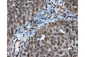 Immunohistochemical staining of paraffin-embedded Kidney tissue using anti-DAPK2 mouse monoclonal antibody. (DAPK2 Antikörper)