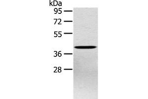 Western Blot analysis of Hepg2 cell using PTX3 Polyclonal Antibody at dilution of 1:400 (PTX3 Antikörper)
