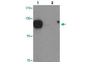 Western blot analysis of KIAA1324 in MCF-7 cell lysate with KIAA1324 polyclonal antibody  at 1 ug/mL in (lane 1) the absence and (lane 2) the presence of blocking peptide. (ELAPOR1 Antikörper  (C-Term))