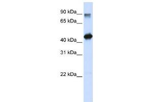 Western Blotting (WB) image for anti-High-Mobility Group 20A (HMG20A) antibody (ABIN2458385) (HMG20A Antikörper)