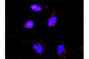 Proximity Ligation Assay (PLA) image for anti-Nuclear Factor of kappa Light Polypeptide Gene Enhancer in B-Cells 1 (NFKB1) (AA 860-969) antibody (ABIN561980)