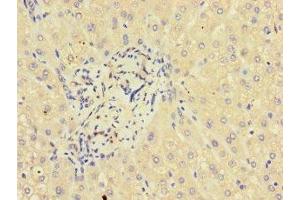 Immunohistochemistry of paraffin-embedded human liver tissue using ABIN7154242 at dilution of 1:100 (GLT8D1 Antikörper  (AA 33-332))