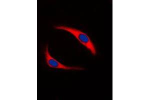 Immunofluorescent analysis of SYK (pY323) staining in Ramos cells. (SYK Antikörper  (pTyr323))