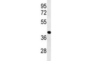 Western blot analysis of ATF1 antibody and Jurkat lysate (AFT1 Antikörper  (AA 193-219))