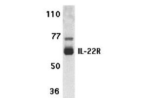 Western Blotting (WB) image for anti-Interleukin 22 Receptor (IL22R) (N-Term) antibody (ABIN1031411) (IL22R Antikörper  (N-Term))