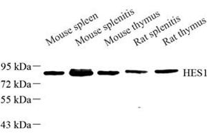 Western blot analysis of HS1 (ABIN7074187) at dilution of 1: 500 (HCLS1 Antikörper)