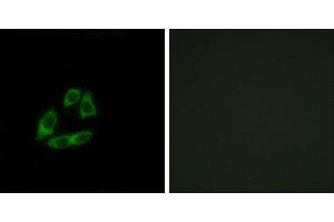 Peptide - +Western blot analysis of extracts from Jurkat cells, using ARFIP1 antibody. (ARFIP1 Antikörper)