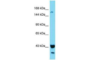 Western Blotting (WB) image for anti-KIAA1683 (KIAA1683) (N-Term) antibody (ABIN2791618) (KIAA1683 Antikörper  (N-Term))