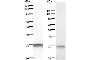 Left: BCL3 staining. (BCL3 Antikörper)