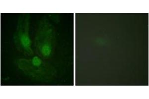Immunofluorescence analysis of HeLa cells, using PKC zeta (Ab-410) Antibody.