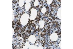 Immunohistochemical staining of human bone marrow with C19orf59 polyclonal antibody  shows strong cytoplasmic positivity in bone marrow poietic cells. (MCEMP1 Antikörper)