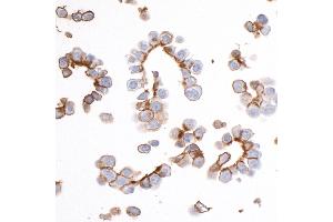 Immunocytochemistry (ICC) image for anti-Epithelial Cell Adhesion Molecule (EPCAM) (AA 264-314) antibody (ABIN7455204) (Rekombinanter EpCAM Antikörper  (AA 264-314))
