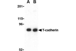 Image no. 1 for anti-Cadherin 13 (CDH13) (N-Term) antibody (ABIN318711) (Cadherin 13 Antikörper  (N-Term))