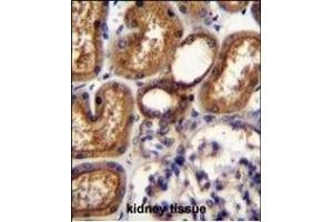 Immunohistochemistry (Paraffin-embedded Sections) (IHC (p)) image for anti-Wilms Tumor 1 (WT1) (AA 346-375) antibody (ABIN655904)