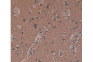 Used in DAB staining on fromalin fixed paraffin- embedded brain tissue (PDE10A Antikörper  (AA 508-779))