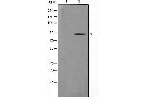 Western blot analysis on COLO205 cell lysate using NR4A3 Antibody,The lane on the left is treated with the antigen-specific peptide. (NR4A3 Antikörper)