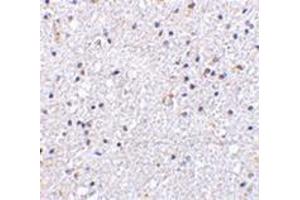 Immunohistochemistry of VISA in human brain tissue with this product at 5 μg/ml. (MAVS Antikörper  (N-Term))