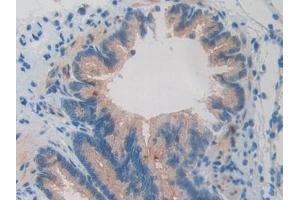 Detection of BMP15 in Rat Lung Tissue using Polyclonal Antibody to Bone Morphogenetic Protein 15 (BMP15) (BMP15 Antikörper  (AA 269-391))