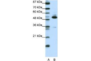 WB Suggested Anti-TADA3L Antibody Titration:  0. (TADA3L Antikörper  (C-Term))