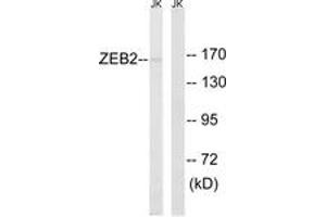Western blot analysis of extracts from Jurkat cells, using ZEB2 Antibody. (ZEB2 Antikörper  (AA 71-120))