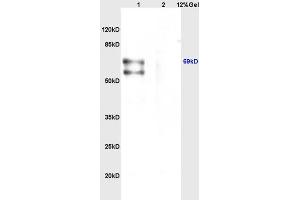 Lane 1: mouse brain lysates Lane 2: mouse heart lysates probed with Anti CHRNA4 Polyclonal Antibody, Unconjugated (ABIN736746) at 1:200 in 4 °C. (CHRNA4 Antikörper  (AA 531-627))