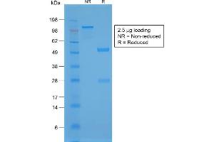 SDS-PAGE Analysis Purified TTF-1 Rabbit Recombinant Monoclonal Antibody (NX2. (Rekombinanter NKX2-1 Antikörper)
