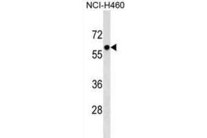 Western Blotting (WB) image for anti-Primase, DNA, Polypeptide 2 (58kDa) (PRIM2) antibody (ABIN2999453) (PRIM2 Antikörper)