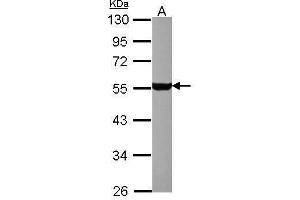 Serotonin Receptor 1A Antikörper