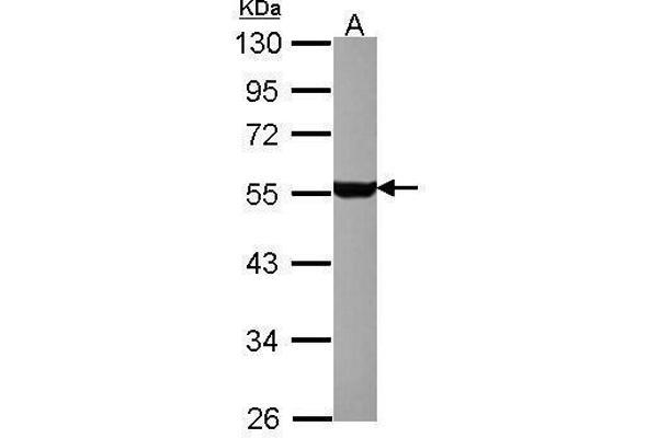 Serotonin Receptor 1A Antikörper