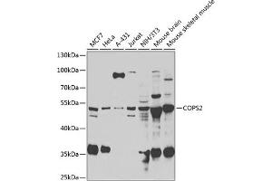COPS2 Antikörper  (AA 1-310)