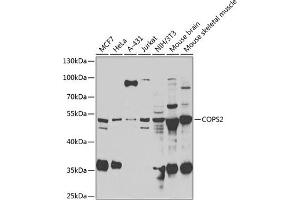 Western blot analysis of extracts of various cell lines, using COPS2 antibody (ABIN6130123, ABIN6138877, ABIN6138878 and ABIN6222819) at 1:1000 dilution. (COPS2 Antikörper  (AA 1-310))