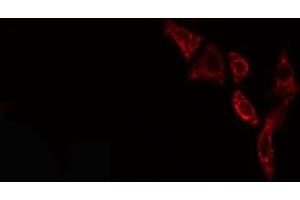 ABIN6276596 staining NIH-3T3 cells by IF/ICC. (PDGFB Antikörper  (N-Term))