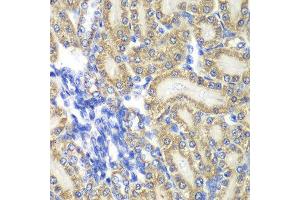 Immunohistochemistry of paraffin-embedded rat kidney using PTGES2 antibody at dilution of 1:100 (x40 lens).