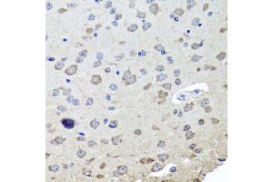 Immunohistochemistry (Paraffin-embedded Sections) (IHC (p)) image for anti-Cholinergic Receptor, Nicotinic, beta 2 (Neuronal) (CHRNB2) antibody (ABIN3068679)