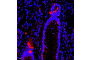 Immunofluorescence of paraffin embedded human colon using SRP14 (ABIN7075596) at dilution of 1:300 (400x lens) (SRP14 Antikörper)