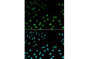 Immunofluorescence analysis of MCF-7 cells using RFC1 antibody. (RFC1 Antikörper  (AA 400-700))