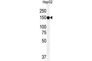 ABCC10 Antibody (ABCC10 Antikörper  (Middle Region))