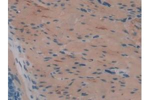 IHC-P analysis of Rat Stomach Tissue, with DAB staining. (HAO1 Antikörper  (AA 102-357))