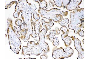 IHC analysis of Cyclophilin B using anti-Cyclophilin B antibody . (PPIB Antikörper  (AA 158-216))