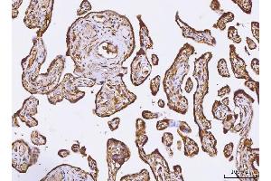 IHC analysis of PKIB using anti-PKIB antibody (ABIN7599546).