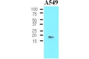 The Cell lysates of A549 (30 ug) were resolved by SDS-PAGE, transferred to nitrocellulose membrane and probed with anti-human PPP1R14A (1:500). (CPI-17 Antikörper  (AA 1-147))