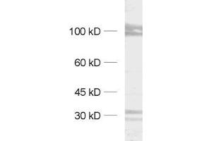 dilution: 1 : 1000, sample: synaptic membrane fraction (LP1) (Kv2.1/KCNB1 Antikörper  (AA 532-857))