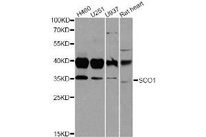 Western blot analysis of extracts of various cell lines, using SCO1 antibody (ABIN2559843) at 1:1000 dilution.