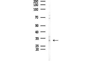 anti-Protease, serine, 1 (Trypsin 1) (PRSS1) (Internal Region) antibody