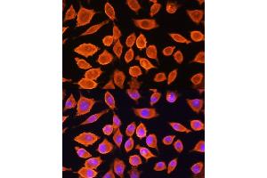 Immunofluorescence (IF) image for anti-E3 Ubiquitin-Protein Ligase SIAH1 (SIAH1) (AA 1-313) antibody (ABIN3016132)