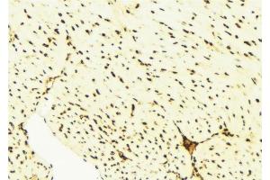 ABIN6276514 at 1/100 staining Mouse liver tissue by IHC-P. (BAG1 Antikörper  (N-Term))